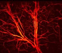 Compactlaser2 Fiorelease 91719 Compactlaser2 Fiorelease 91719