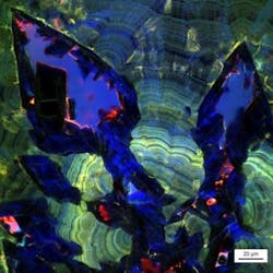 Content Dam Bow Online Articles 2018 09 Kidney Stone Content Dam Bow Online Articles 2018 09 Kidney Stone