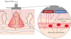 FIGURE 1. Detailed is the principle of laser Doppler flowmetry (LDF).