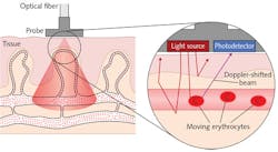 FIGURE 1. Detailed is the principle of laser Doppler flowmetry (LDF). FIGURE 1. Detailed is the principle of laser Doppler flowmetry (LDF).