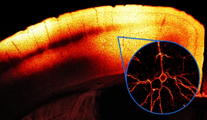 Red fluorescent protein helps view live brain function Laser Focus World