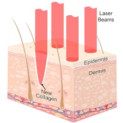 Coherentlfw Dilasmedapps Fig1 Nov2018 Coherentlfw Dilasmedapps Fig1 Nov2018