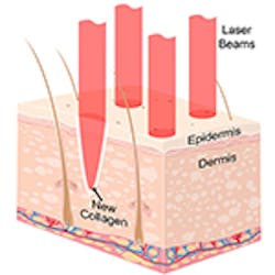 LaserFousWorld Test LaserFousWorld Test