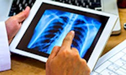 LaserFousWorld Test LaserFousWorld Test