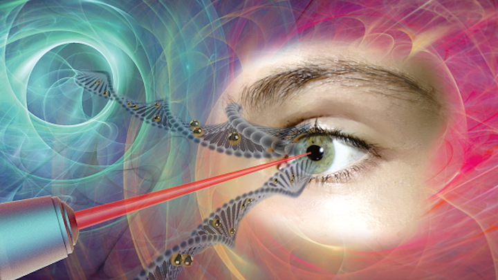 Gold nanoparticles act as nanolenses to concentrate the energy produced by the extremely short pulse of a femtosecond laser to create a nanoscale incision on the surface of the eye's retina cells. This technology, which preserves cell integrity, can be used to effectively inject drugs or genes into specific areas of the eye, offering new hope to people with glaucoma, retinitis, or macular degeneration. (Image credit: Polytechnique Montreal)