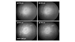 Monochromatic images of a mouse retina are displayed at four different wavelengths (boxes indicate locations of amyloid measurement areas). Illumination with 510 nm blue light (a) shows bright reflections from nerve fibers and blood vessels. The 555 nm green light images (b) show dark large blood vessels, while nerve fibers in the center appear bright (veins are darker than arteries because of greater deoxyhemoglobin absorption). The 615 nm red light images (c) show bright arteries and veins, while 705 nm near-infrared light (d) reveals less-bright vessels but more sharply focused choroidal capillaries near the center.