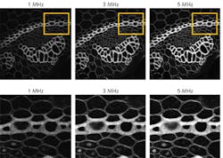 FIGURE 2. Increasing the repetition rate of a laser increases the signal-to-noise ratio (SNR), as shown by imaging this convallaria sample at 1330 nm at different repetition rates using the KMLabs Y-Fi OPA. However, increasing repetition rate also increases average power, which can cause damage. Changing repetition rate and thus average power for each sample is a powerful tool for ensuring maximum depth penetration with minimal SNR necessary to avoid sample damage. FIGURE 2. Increasing the repetition rate of a laser increases the signal-to-noise ratio (SNR), as shown by imaging this convallaria sample at 1330 nm at different repetition rates using the KMLabs Y-Fi OPA. However, increasing repetition rate also increases average power, which can cause damage. Changing repetition rate and thus average power for each sample is a powerful tool for ensuring maximum depth penetration with minimal SNR necessary to avoid sample damage.