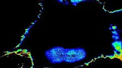 Content Dam Bow Online Articles 2018 12 Rsz Coverart Chemoresistantcell