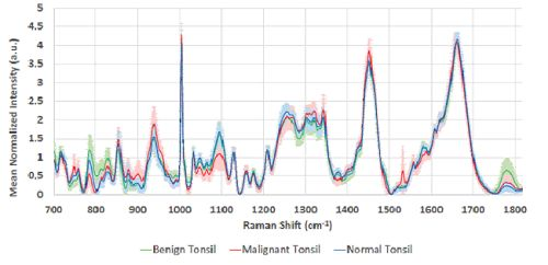 Content Dam Bow Online Articles 2018 12 Throat Cancer Raman Spectroscopy