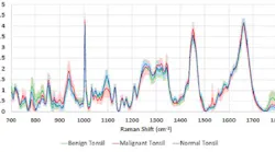 Content Dam Bow Online Articles 2018 12 Throat Cancer Raman Spectroscopy