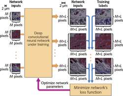 FIGURE 3. Here, a deep neural network developed by Aydogan Ozcan and his colleagues is trained to increase the resolution of images by providing low-resolution input images and corresponding high-resolution training labels to the neural network. Once training is complete, the network can take any low-resolution image and quickly generate, in a single pass forward, a higher-resolution version with improved field of view and depth of field. FIGURE 3. Here, a deep neural network developed by Aydogan Ozcan and his colleagues is trained to increase the resolution of images by providing low-resolution input images and corresponding high-resolution training labels to the neural network. Once training is complete, the network can take any low-resolution image and quickly generate, in a single pass forward, a higher-resolution version with improved field of view and depth of field.