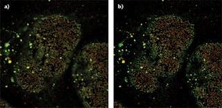 FIGURE 2. Images of a nuclear pore acquired with the Olympus FV3000 confocal system before (a) and after (b) nonlinear deconvolution using an advanced maximum likelihood estimation (AdvMLE) deconvolution algorithm.