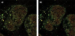 FIGURE 2. Images of a nuclear pore acquired with the Olympus FV3000 confocal system before (a) and after (b) nonlinear deconvolution using an advanced maximum likelihood estimation (AdvMLE) deconvolution algorithm. FIGURE 2. Images of a nuclear pore acquired with the Olympus FV3000 confocal system before (a) and after (b) nonlinear deconvolution using an advanced maximum likelihood estimation (AdvMLE) deconvolution algorithm.
