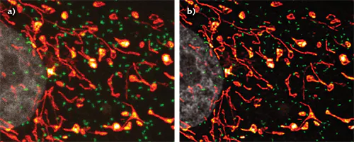 Confocal Image Process Microscopy/Image Processing: A deconvolution revolution for confocal ...