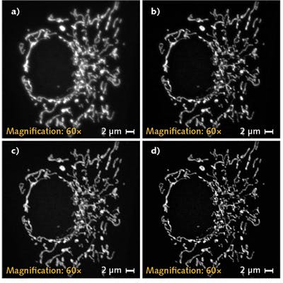 Microscopy/Image Processing: A deconvolution revolution for confocal ...