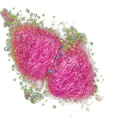 Nanolive's 3D Cell Explorer microscope, which makes tomographic images of living cells, won top prize in Startup World's Photonics awards at LASER World of Photonics 2015. Nanolive's 3D Cell Explorer microscope, which makes tomographic images of living cells, won top prize in Startup World's Photonics awards at LASER World of Photonics 2015.