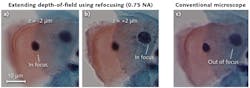 FIGURE 3. Recovered images of a pap smear demonstrate depth-of-field extension using a 3D tomographic reconstruction routine (a, b). By comparison, a conventional incoherent brightfield image uses a relatively large illumination NA to produce a smaller depth of field (c). We used a 40X, 0.75 objective in this demonstration. FIGURE 3. Recovered images of a pap smear demonstrate depth-of-field extension using a 3D tomographic reconstruction routine (a, b). By comparison, a conventional incoherent brightfield image uses a relatively large illumination NA to produce a smaller depth of field (c). We used a 40X, 0.75 objective in this demonstration.
