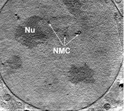 FIGURE. A slice through the nucleus of a mouse adenocarcinoma cell is taken using X-ray nanotomography. It reveals the nucleolus (Nu) and the membrane channels running across the nucleus (NMC).