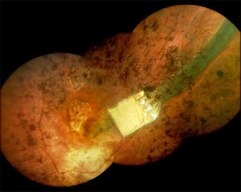 Content Dam Etc Medialib New Lib Laser Focus World Online Articles 2010 11 98227