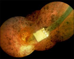 Content Dam Etc Medialib New Lib Laser Focus World Online Articles 2010 11 98227 Content Dam Etc Medialib New Lib Laser Focus World Online Articles 2010 11 98227