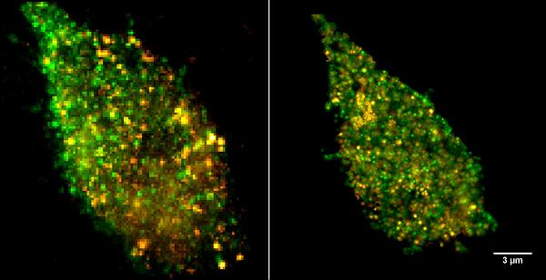 A cell surface is imaged with sandia's improved superresolution-microscopy technique (right) and a previous technique (left). Orange areas correspond to the bacterial lipopolysaccharide (LPS) derived from E. coli, and the green areas correspond to the cell's TLR4 receptors.