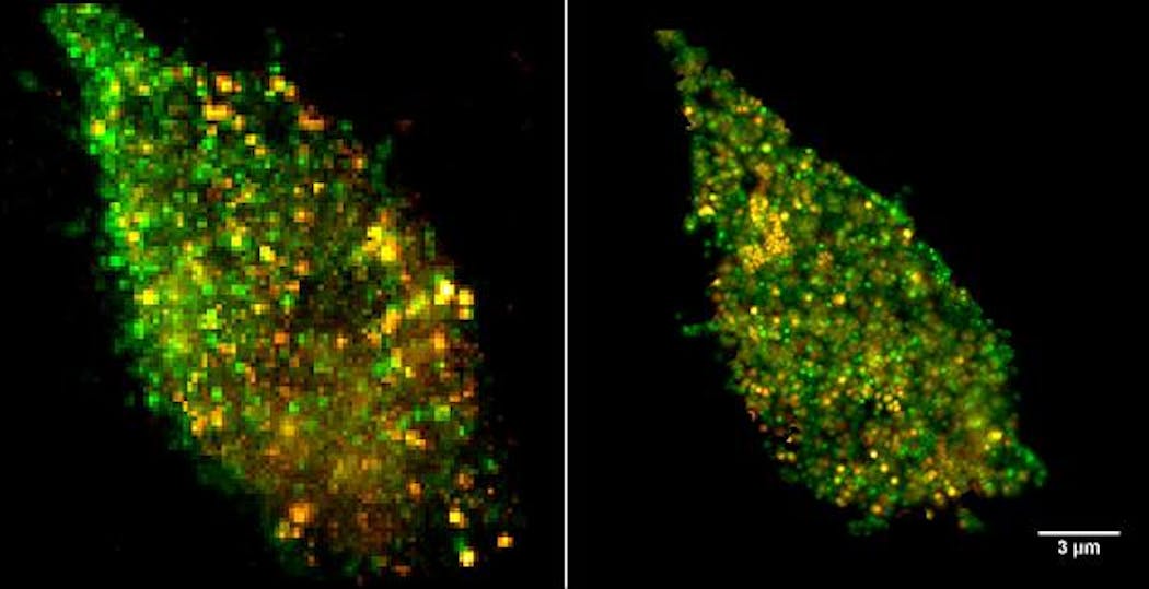 A cell surface is imaged with sandia&apos;s improved superresolution-microscopy technique (right) and a previous technique (left). Orange areas correspond to the bacterial lipopolysaccharide (LPS) derived from E. coli, and the green areas correspond to the cell&apos;s TLR4 receptors.