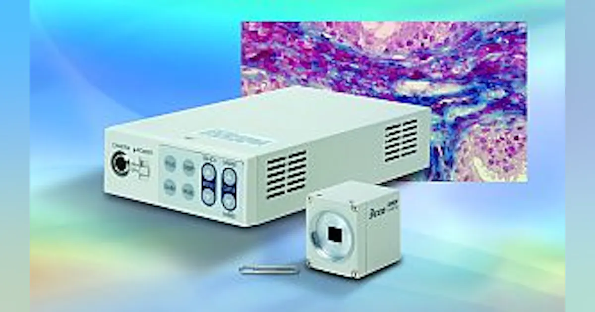 Toshiba HD microscope camera uses a 2.1 Mpixel sensor | Laser Focus World