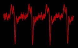 Content Dam Etc Medialib Platform 7 Laser Focus World Articles Online Exclusive Articles 2010 Global 26838 Content Dam Etc Medialib Platform 7 Laser Focus World Articles Online Exclusive Articles 2010 Global 26838