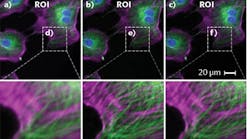 A laptop-based deep learning system converts low-resolution fluorescence microscopy images (a) into superresolution images (b) that compare favorably with images produced using high-resolution equipment (c); images on the bottom row depict detail from those on the top row.