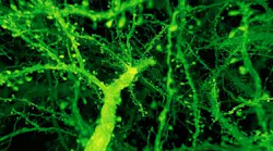 Content Dam Bow Online Articles 2019 02 Dendritic Spines 2000px Web