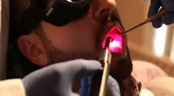 Content Dam Bow Online Articles 2019 02 Laser Light Dental Web