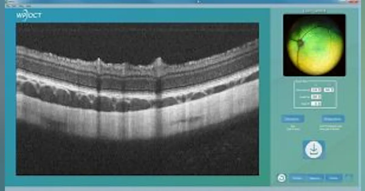 Live Software Oct OCT software platform by Wasatch Photonics | Laser Focus World
