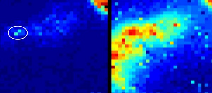Content Dam Lfw En Articles 2017 09 Single Photon Camera Tracks Location Of Endoscope Deep Within The Body Leftcolumn Article Thumbnailimage File