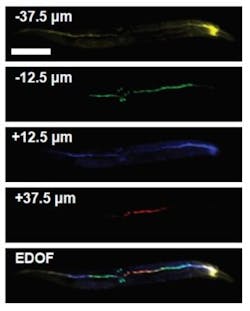 Imaging C Elegans Web Imaging C Elegans Web