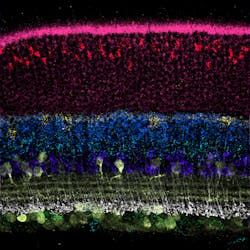 Saber Fish Retinal Layer Organization Saber Fish Retinal Layer Organization