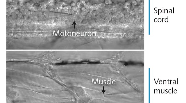 FIGURE 1. The transparent zebrafish embryo enables paired patch clamp measurements of spinal neurons and locomotory muscle cells. Two chevron-shaped repetitive segments of tail muscle are shown. The two patch clamp recording electrodes are shown for an individual motoneuron and muscle cell. Only one electrode is visible in the field because placement of the electrodes during formation of whole-cell recording mode is done under very high magnification.