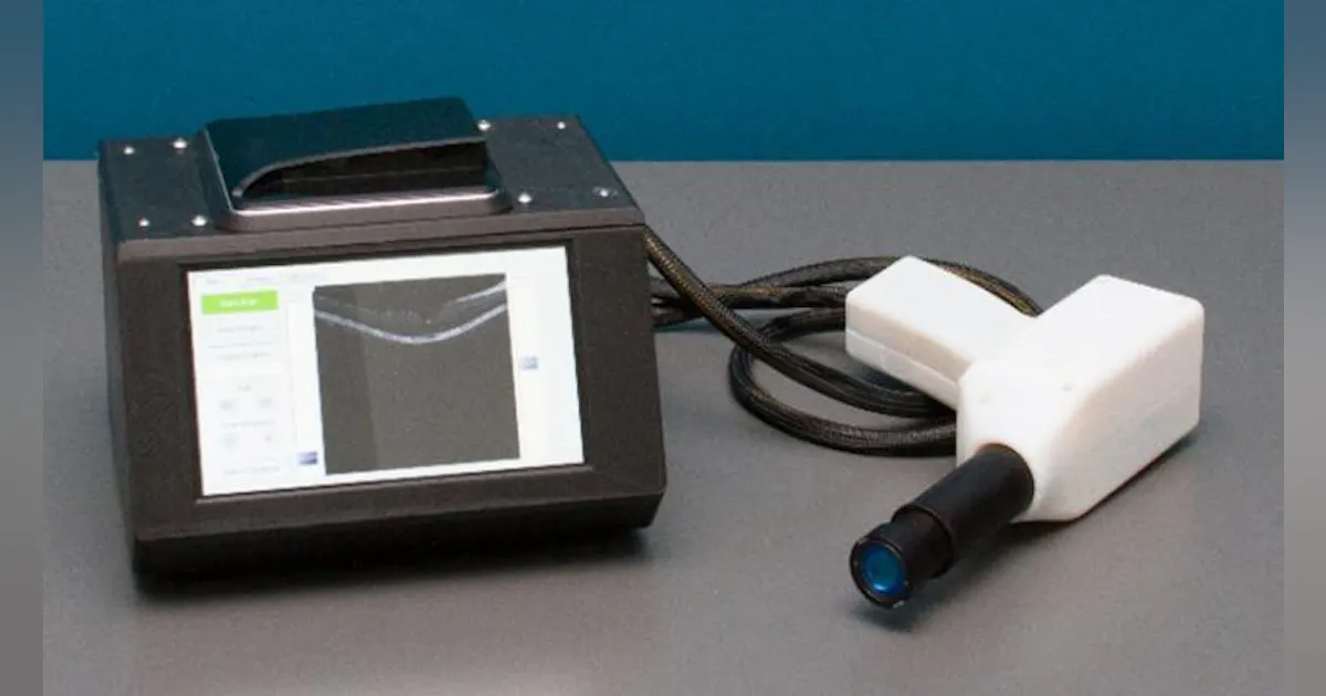 Scanner Inside Oct Ultralight, low-cost OCT scanner screens for retinal diseases | Laser ...