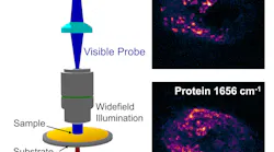 Cancer Imaging