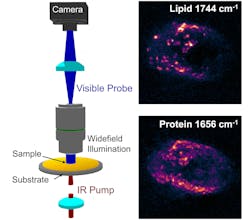 Cancer Imaging 5d3b3dd34e532 Cancer Imaging 5d3b3dd34e532
