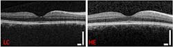 Retina Small Retina Small