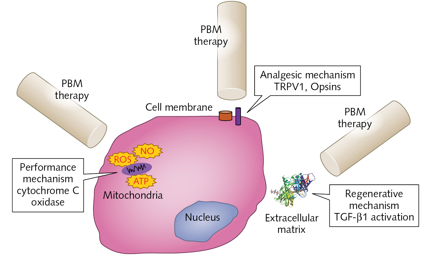 Photobiomodulation Therapy—easy To Do, But Difficult To Get Right ...