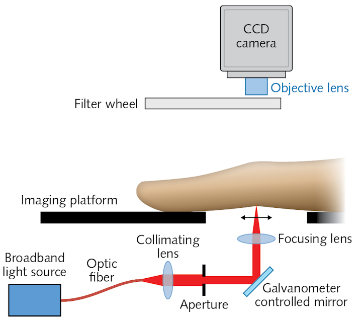 A fast, low-cost, highly sensitive diffuse optical imaging system acquires optical transmission images dorsally to provide objective, quantitative analysis for rheumatoid arthritis (RA) diagnosis and monitoring.