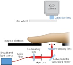 A fast, low-cost, highly sensitive diffuse optical imaging system acquires optical transmission images dorsally to provide objective, quantitative analysis for rheumatoid arthritis (RA) diagnosis and monitoring. A fast, low-cost, highly sensitive diffuse optical imaging system acquires optical transmission images dorsally to provide objective, quantitative analysis for rheumatoid arthritis (RA) diagnosis and monitoring.