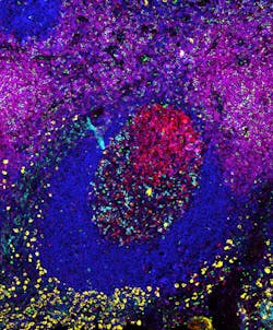 Ffpe Human Tonsil Ffpe Human Tonsil