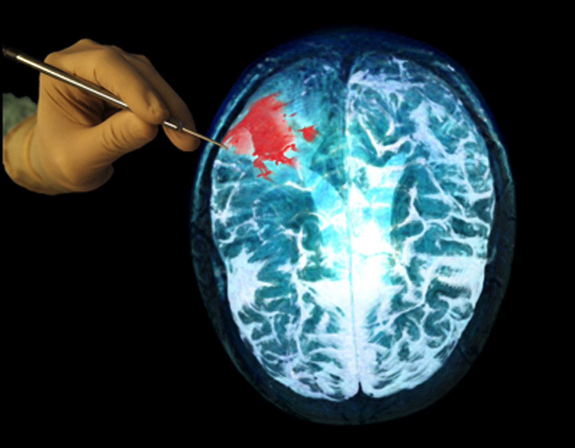 Ods Medical Ods Medical Inc Announces Sentry System Prototype 5d4446ee53e8a