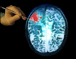 Ods Medical Ods Medical Inc Announces Sentry System Prototype 5d4446ee53e8a Ods Medical Ods Medical Inc Announces Sentry System Prototype 5d4446ee53e8a