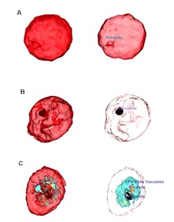 Tomocube Plasmodium Falciparum Rb Cs 5d556d3dc68ca Tomocube Plasmodium Falciparum Rb Cs 5d556d3dc68ca