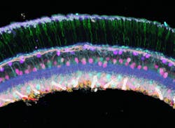 Mouse Retina Cryosections 5d5d962a5bf72 Mouse Retina Cryosections 5d5d962a5bf72