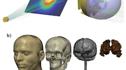 FIGURE 1. These freeform optics were designed in LightTools (a). The software can help identify manufacturing tolerances for tailored surfaces used in freeform optics for illumination. Head models are created from image data using Synopsys Simpleware software (b). Simpleware can be used in conjunction with LightTools to run detailed optical scenarios in 3D anatomical models for biomedical applications. FIGURE 1. These freeform optics were designed in LightTools (a). The software can help identify manufacturing tolerances for tailored surfaces used in freeform optics for illumination. Head models are created from image data using Synopsys Simpleware software (b). Simpleware can be used in conjunction with LightTools to run detailed optical scenarios in 3D anatomical models for biomedical applications.