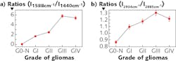 FIGURE 2. These data plots present typical resonance Raman results from experiments; two key peak ratios vary from normal human brain tissues to glioma tissues with increasing malignancy.2 FIGURE 2. These data plots present typical resonance Raman results from experiments; two key peak ratios vary from normal human brain tissues to glioma tissues with increasing malignancy.2